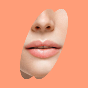 Dunne lippen - lip flip behandeling Antwerpen - Pêche Skin Clinic