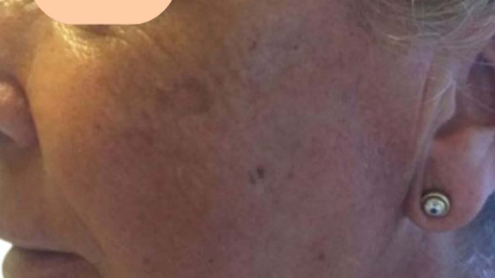 V3 1 after