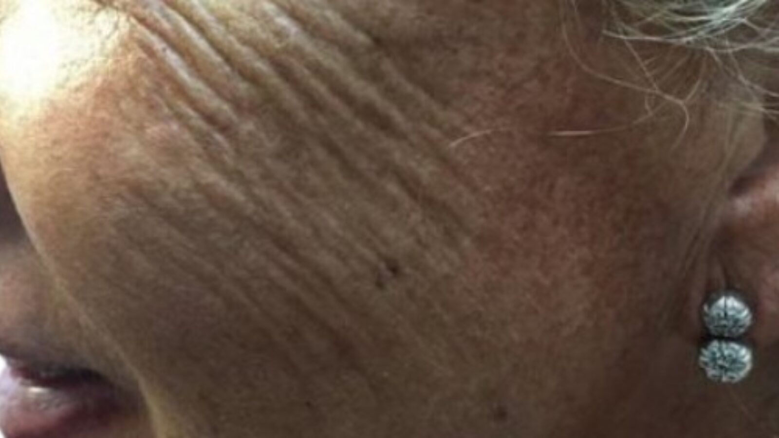 V3 1 before