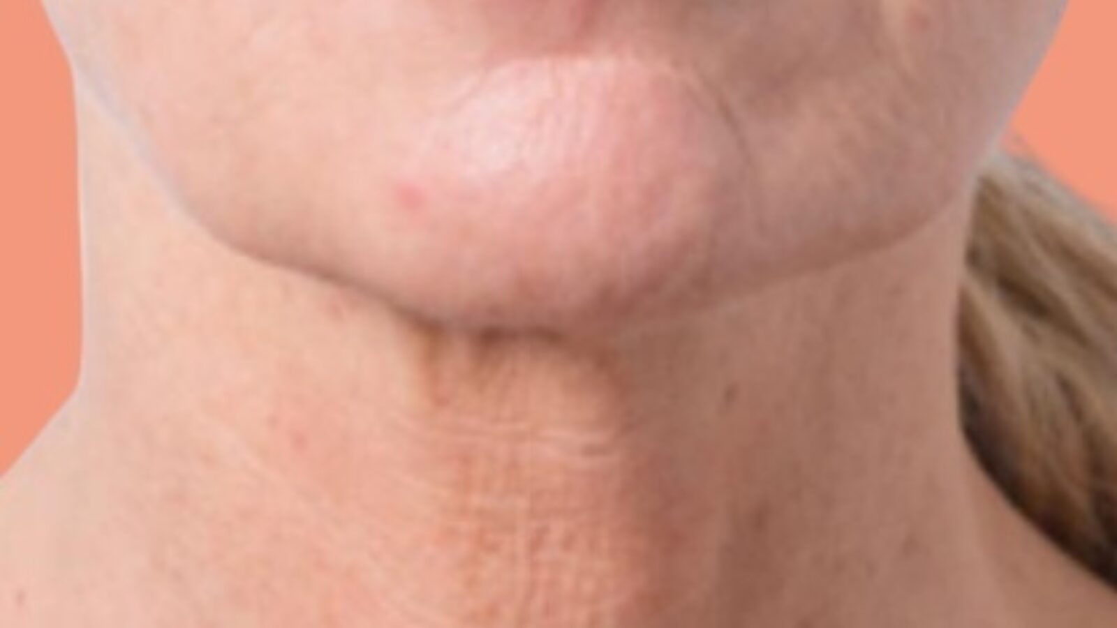 V3 4 after