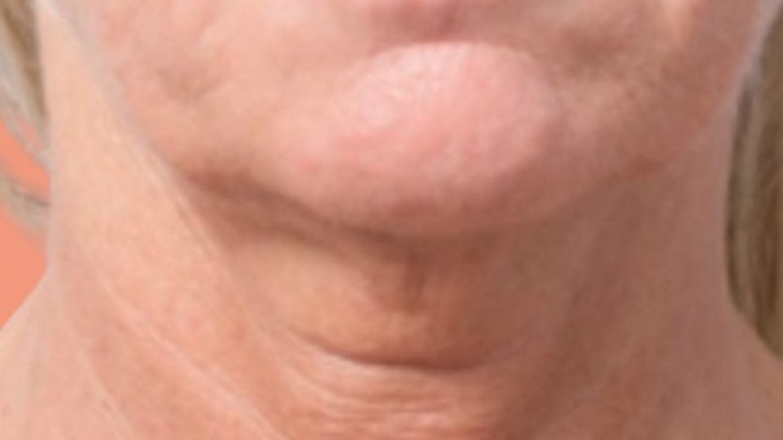 V3 4 before